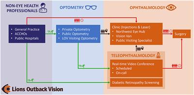 Benefits of Integrating Telemedicine and Artificial Intelligence Into Outreach Eye Care: Stepwise Approach and Future Directions